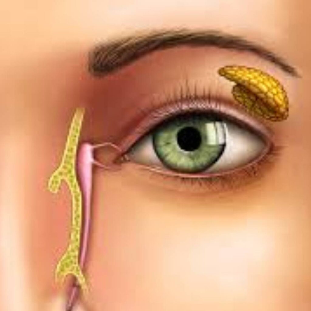 Endoscopic DCR