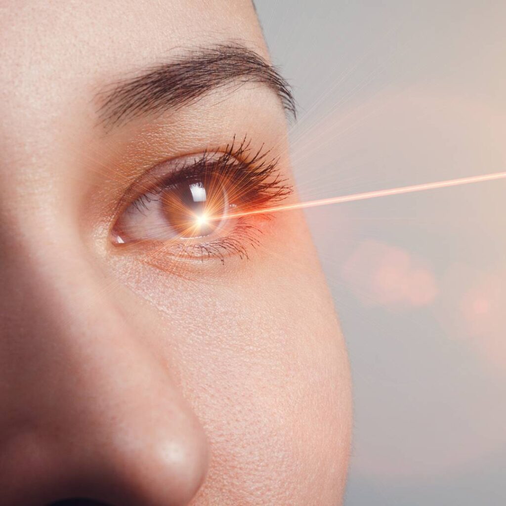 Lasers for Diabetic Eye
